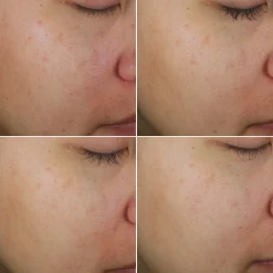 Rotina Bright Intense Mista Novage+ 5 unidades